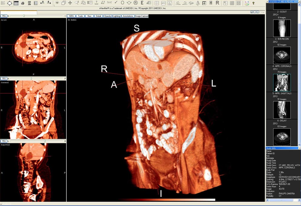 CT scan color