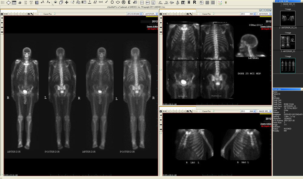 Nuclear medicine non cardiac