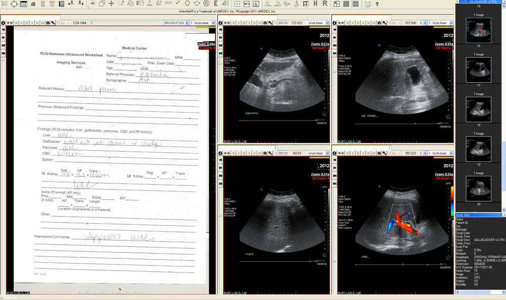 Ultrasound general vascular